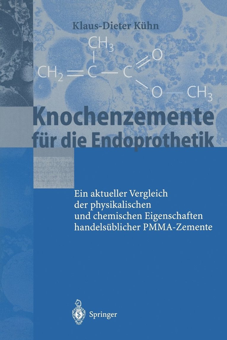 Knochenzemente fr die Endoprothetik 1