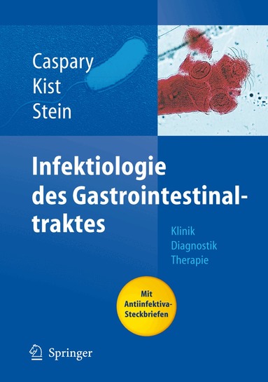 Wolfgang F. Caspary, Manfred Kist, Jürgen Stein - Infektiologie des Gastrointestinaltraktes, Inbunden