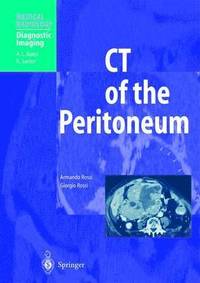 bokomslag CT of the Peritoneum