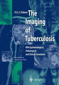 bokomslag The Imaging of Tuberculosis
