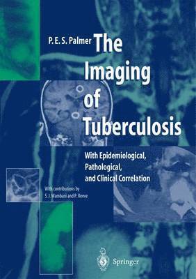 bokomslag Imaging of Tuberculosis