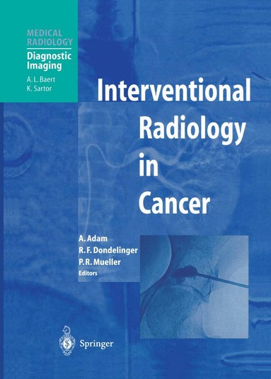 Andreas Adam, Robert F. Dondelinger, Peter R. Mueller - Interventional Radiology in Cancer, Inbunden