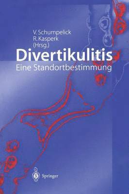 Divertikulitis 1