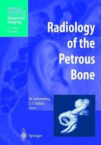 bokomslag Radiology of the Petrous Bone