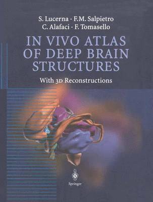 S. Lucerna, F.M. Salpietro, C. Alafaci, F. Tomasello, F. M. Salpietro - In Vivo Atlas of Deep Brain Structures, Inbunden