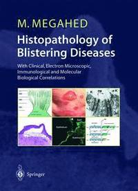 bokomslag Histopathology of Blistering Diseases