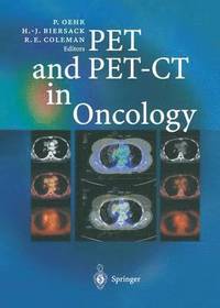 bokomslag PET and PET-CT in Oncology