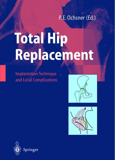 bokomslag Total Hip Replacement