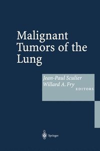 bokomslag Malignant Tumors of the Lung