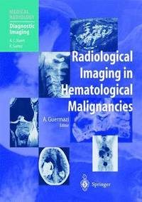 bokomslag Radiological Imaging in Hematological Malignancies
