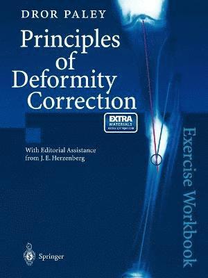 Principles of Deformity Correction 1