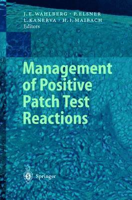 bokomslag Management of Positive Patch Test Reactions