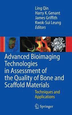 Advanced Bioimaging Technologies in Assessment of the Quality of Bone and Scaffold Materials 1