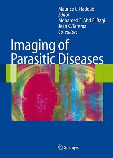 bokomslag Imaging of Parasitic Diseases