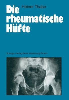 bokomslag Die rheumatische Hüfte