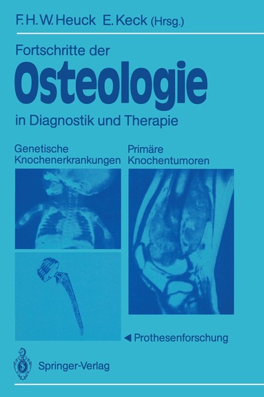 Friedrich H.W. Heuck, Elmar Keck - Fortschritte der Osteologie in Diagnostik und Therapie, Häftad
