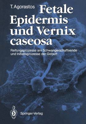 Fetale Epidermis und Vernix caseosa 1