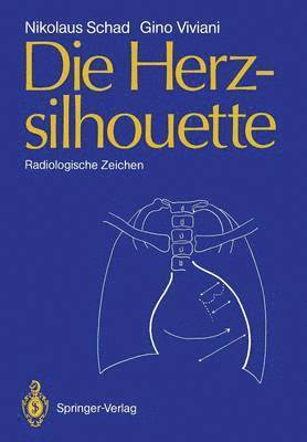 Die Herzsilhouette 1