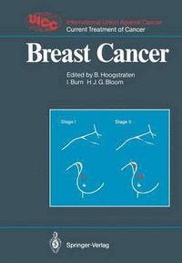 bokomslag Breast Cancer