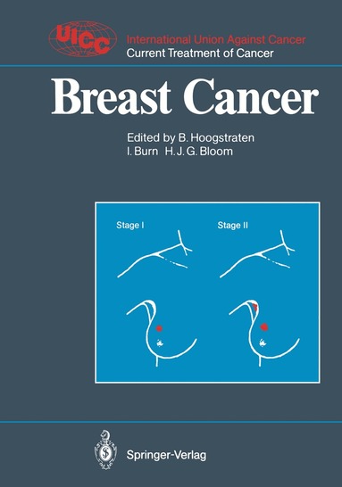 Barth Hoogstraten, Ian Burn, H. Julian G. Bloom - Breast Cancer, Häftad