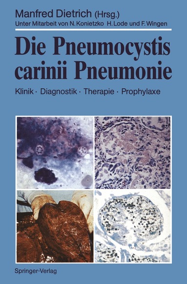 Manfred Dietrich, Manfred Dietrich - Die Pneumocystis carinii Pneumonie, Häftad