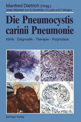 bokomslag Die Pneumocystis carinii Pneumonie