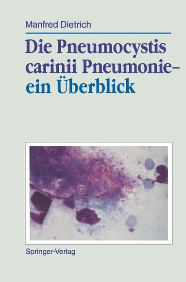 Manfred Dietrich - Die Pneumocystis carinii Pneumonie— ein Überblick, Häftad
