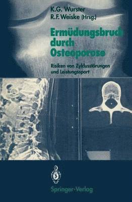 Ermüdungsbruch durch Osteoporose
