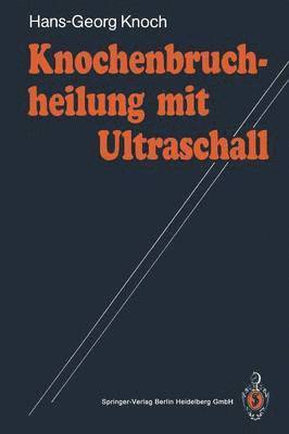 bokomslag Knochenbruchheilung mit Ultraschall