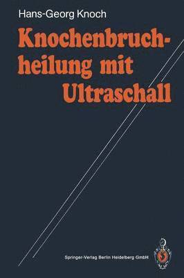 Hans-Georg Knoch - Knochenbruchheilung mit Ultraschall, Häftad