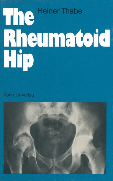 Heiner Thabe - Rheumatoid Hip, Häftad