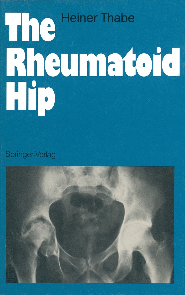 Heiner Thabe - Rheumatoid Hip, Häftad