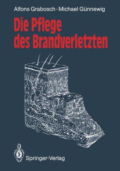 Alfons Grabosch, Michael Günnewig, Alfons Grabosch, Michael Günnewig - Die Pflege des Brandverletzten, Häftad