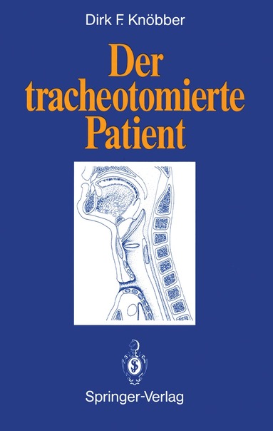 Dirk F. Knöbber - Der tracheotomierte Patient, Häftad