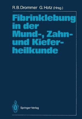 bokomslag Fibrinklebung in der Mund-, Zahn- und Kieferheilkunde