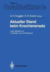 bokomslag Aktueller Stand beim Knochenersatz