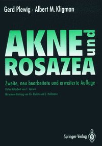 bokomslag Akne Und Rosazea
