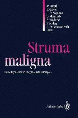 Struma maligna 1