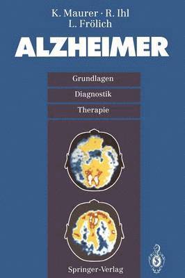 bokomslag Alzheimer