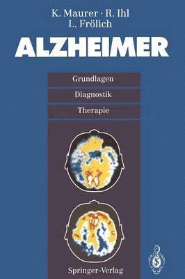 Alzheimer 1