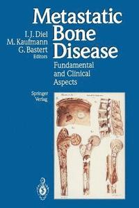 bokomslag Metastatic Bone Disease