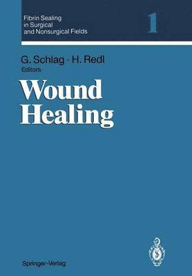 Fibrin Sealing in Surgical and Nonsurgical Fields 1