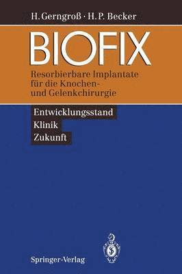 Heinz Gerngroß, Horst P. Becker, Heinz Gerngroß, Horst P. Becker - BIOFIX, Häftad