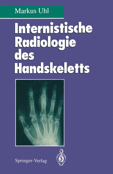 bokomslag Internistische Radiologie des Handskeletts