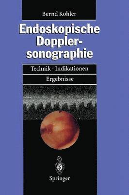 bokomslag Endoskopische Dopplersonographie