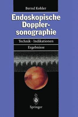 Bernd M. Kohler - Endoskopische Dopplersonographie, Häftad