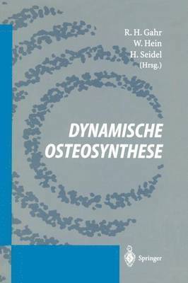 Dynamische Osteosynthese 1