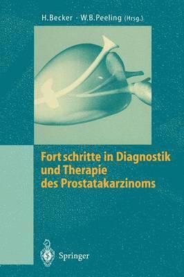 Hermann Becker, W.B. Peeling, W. B. Peeling - Fortschritte in Diagnostik und Therapie des Prostatakarzinoms, Häftad