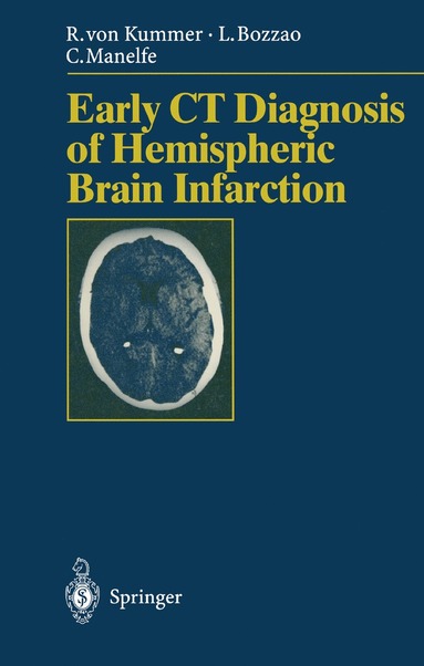 bokomslag Early CT Diagnosis of Hemispheric Brain Infarction