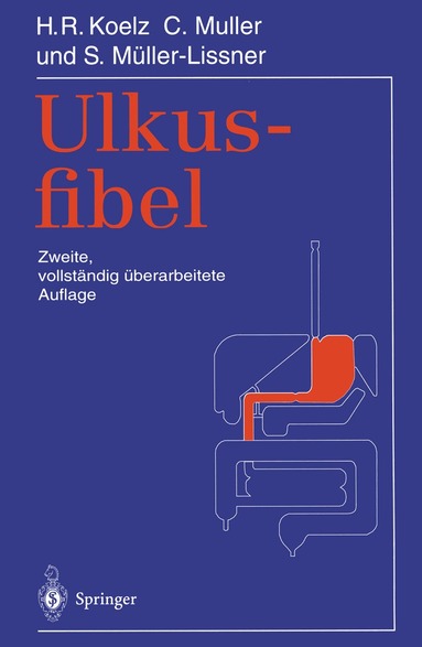 Hans R. Koelz, Claude Muller, Stefan Müller-Lissner, Hans R. Koelz, Claude Muller - Ulkusfibel, Häftad